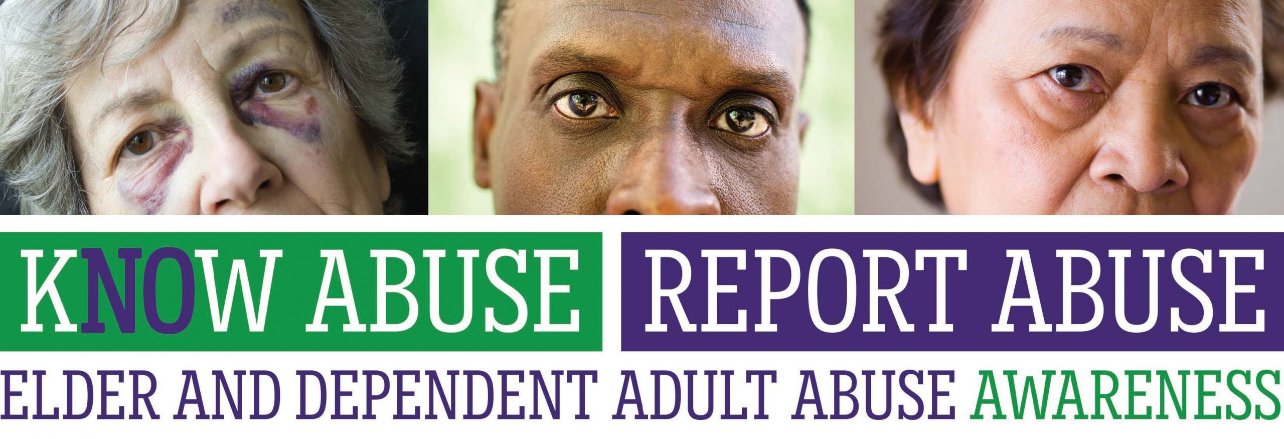 Elder and dependent adult abuse awareness banner showing close-up faces of three older adults with visible signs of injury or distress. Text reads: ‘Know Abuse. Report Abuse. Elder and Dependent Adult Abuse Awareness.’ Message encourages recognizing and reporting abuse of vulnerable adults.”